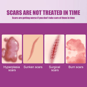 Herbicos acné cicatrice enlèvement Creamvergetures crème réparatrice Lotion pour le corps grossesse femmes jour adultes acide hyaluronique - Product Image 6