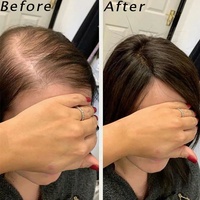 LONGFOR 100% Cheveux Humains Chinois Femmes Topper Base de Soie Cheveux Humains Toupet