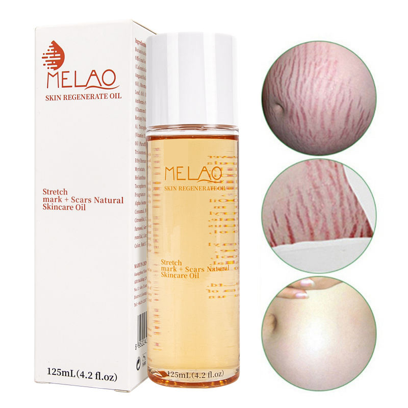 stretch mark oil