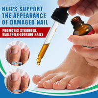 Vente en Gros Marque Blanche Traitement Mycoses Ongles Force Maximale Solution Anti-Fongique Réparation Ongles Sérum Mycoses Ongles Pieds