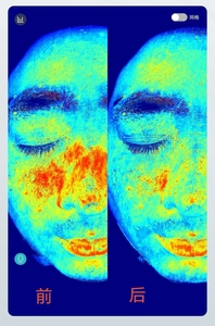 Système d'<span class=keywords><strong>analyse</strong></span> cutanée IA avec écran tactile Android de 21,5 pouces et détection de lumière UV RGB pour l'<span class=keywords><strong>analyse</strong></span> des pores, des rides et de l'acné - Product Image 5