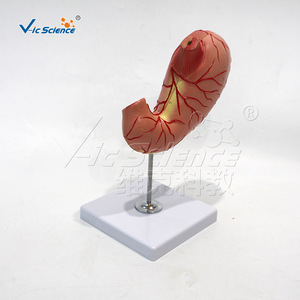 VIC-D021B Modelo de Estómago Natural Grande de 2 Componentes: Modelo de Enseñanza de Úlcera Gástrica Humana, Modelo de Enseñanza Patológica - Product Image 3