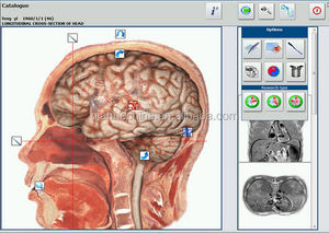 JYTOP 2026 NLS Bioplasm NLS Gezondheidsanalysator Batterij Di Analisi Oordopjes Afzonderlijk Verkrijgbaar - Product Image 2