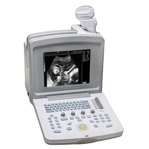 Perangkat Ultrasound Dokter Hewan Dokter Hewan Digital Portabel Mesin Ultrasound 5 Inci - Product Image 2