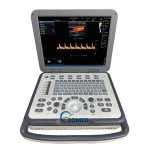 Escáner de Ultrasonido Portátil con Pantalla Doppler a Color de 15 Pulgadas, Sistema de Ultrasonido Cardíaco Portátil Veterinario y Humano CU38/CU60 - Product Image 1