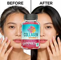 Gummies au collagène avec vitamine C - Favorise la santé des cheveux, de la peau et des ongles - Complément beauté fruité pour adultes