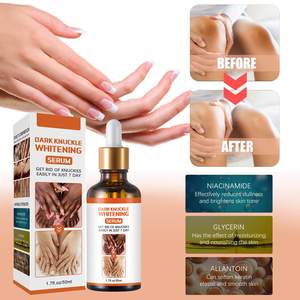 50ml Dark Knuckle Finger Codo Rodilla Melanina Aclarar Esencia Articulaciones Loción brillante Manchas oscuras y removedor de pigmentación Suero Blanqueador - Product Image 6