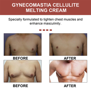 Crème pour la poitrine South Moon Gynecomastia Cellulite Melting, crème réductrice <span class=keywords><strong>de</strong></span> poitrine masculine, crème anti-affaissement et raffermissante pour hommes - Product Image 4