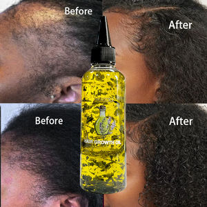 Private Label 100% Natural Orgânico Scalp Cuidados Produtos para o Cabelo Mix Ervas Rosemary Castor Oil Homens Mulheres Baby Hair Growth Oil - Product Image 1