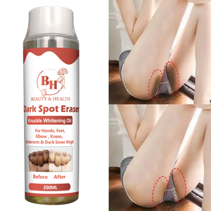 Aceite Blanqueador de Semillas de Vitamina E Frescas de Marca Privada, Reducción Efectiva de Manchas Oscuras, Reducción de Melanina, Blanqueamiento de Piernas y Codos, Esencial Puro - Product Image 3