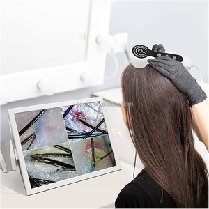 Analizzatore del Cuoio Capelluto di Grado Professionale da 15 Pollici, Scanner per Follicoli Capillari per Cliniche di Cura dei Capelli - Product Image 2