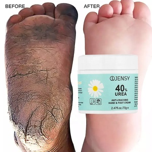 <span class=keywords><strong>Crème</strong></span> Soin des <span class=keywords><strong>Pieds</strong></span> <span class=keywords><strong>pour</strong></span> Talons Fissurés Exfoliante Anti-Crevasses Élimination Peaux Mortes Réparatrice Blanchissante <span class=keywords><strong>à</strong></span> <span class=keywords><strong>l</strong></span>'<span class=keywords><strong>Urée</strong></span> - Product Image 1