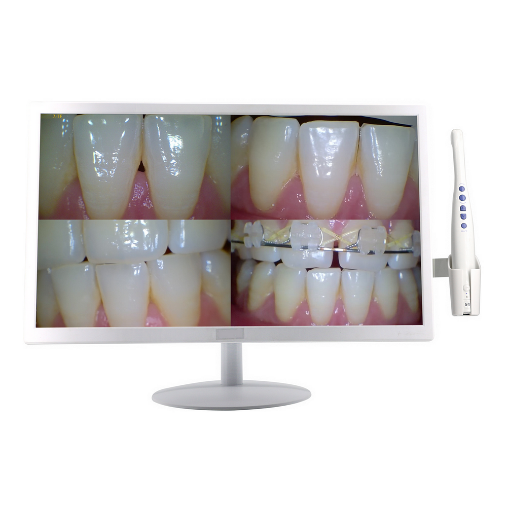 19 дюймовый ЖК-экран Sony 8,0 мега 5G Wi-Fi беспроводной наконечник стоматологическая интраоральная камера