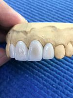 YUCERA Dental Lab Lithium Disilicate Ingote Press HT/LT tablet untuk laboratorium gigi