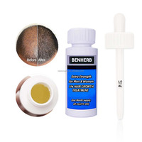 Kit de sérum capillaire 2-en-1 à base de gingembre biologique végétalien pour la repousse et la lutte contre la chute des cheveux, 60 ml, pour usage domestique