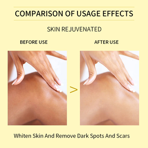 Etiqueta privada 110ml Extra fuerte Peeling Oil Scar Eliminar las estrías Blanqueamiento Yellow Peeling Oil - Product Image 5