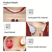 KyrenMed Modèle d'hémorroïde interne externe rectale humaine Modèle pathologique anorectal Modèle de lésion de fissure du rectum Taille réelle