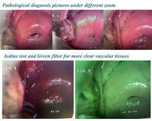 गिरी KN-2200 0.8MP स्त्री रोग स्त्री रोग वीडियो Colposcope कैमरा पूर्ण HD 1080p इलेक्ट्रॉनिक colposcope - Product Image 6