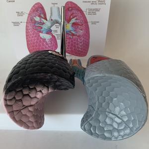 Modelo de Comparación de Ciencias Médicas: Pulmones Humanos Fumadores, Patología, Modelo de Enfermedad, Modelo de Enfermedad Orgánica, Modelo Antidrogas - Product Image 6