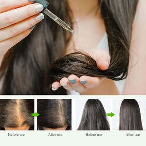 Wholesale Bulk Cold Pressed Amla Seed <strong>Oil</strong> Raw Indian Gooseberry Organic Amla Carrier <strong>Oil</strong> for Hair Growth Body Massage - Product Image 5