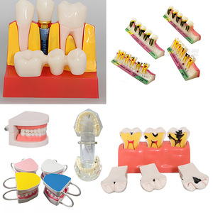 Modèle d'enseignement dentaire anatomique en résine pour implant dentaire, préparation au brossage des prothèses - Product Image 1