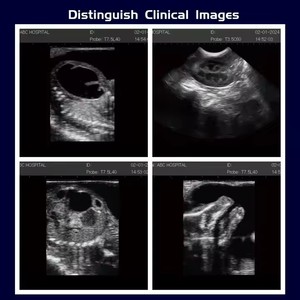 CE layar LED 15 inci hewan catatan dokter hewan peliharaan anjing kucing kuda ternak Ultrasound pemindai mesin USG - Product Image 2