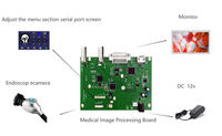 Module de caméra endoscopique FHD 1080P avec 4 interfaces de sortie, carte mère d'enregistreur vidéo numérique, équipement de diagnostic vétérinaire en métal CE