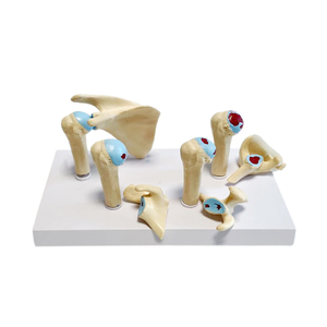 Modello di Articolazione della Spalla Umana, Osso Scapolare, Patologia, per Medici e Pazienti, Dimostra Reumatismo, Periartrite della Spalla, Ortopedia - Product Image 6