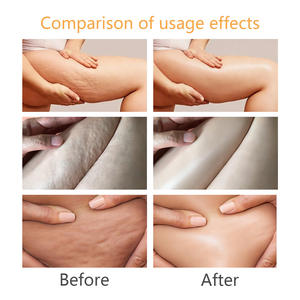 Huile de massage <span class=keywords><strong>anti</strong></span>-<span class=keywords><strong>cellulite</strong></span> à base d'extraits de plantes pour la perte de poids naturelle, pour femmes et hommes - Product Image 5