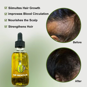 Tratamiento Capilar Natural Mega Growth, Mezcla <span class=keywords><strong>de</strong></span> Hierbas con <span class=keywords><strong>Aceite</strong></span> <span class=keywords><strong>de</strong></span> Argán <span class=keywords><strong>y</strong></span> Romero para el Crecimiento <span class=keywords><strong>del</strong></span> Cabello, <span class=keywords><strong>Beneficios</strong></span> Anticaspa - Product Image 3