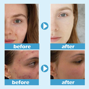 Crème <span class=keywords><strong>de</strong></span> <span class=keywords><strong>nuit</strong></span> hydratante profondément lissante personnalisée 100g <span class=keywords><strong>masque</strong></span> facial Hydra eau glacée humide <span class=keywords><strong>masque</strong></span> crème pour le visage endormi - Product Image 3