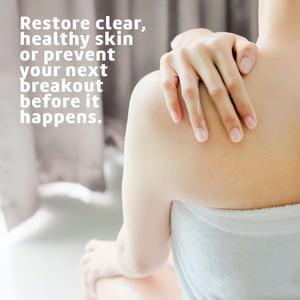 <span class=keywords><strong>Pommade</strong></span> au soufre Crème à base de soufre <span class=keywords><strong>pour</strong></span> le visage et le corps Anti Pimple Remover - Product Image 2