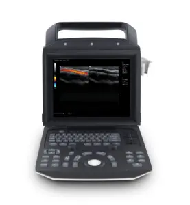 Zoncare M5 con người & thú y dễ dàng scan xách tay cầm 3D máy siêu âm để bán