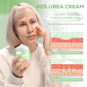 Crème YECUCE OEM 40% Urée + 2% Acide Salicylique, Marque Privée, pour les Pieds et les Mains, Contre les Talons Fissurés et les Callosités, 150g, Logo Personnalisé - Product Image 5