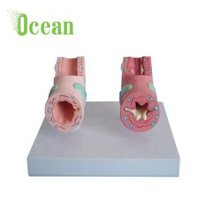 Modè<span class=keywords><strong>le</strong></span> de bronchies asthmatiques normales, modè<span class=keywords><strong>le</strong></span> médical de pathologie trachéale pour la publicité, l'éducation <span class=keywords><strong>et</strong></span> la démonstration - Product Image 4