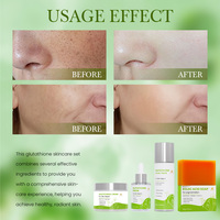 Ensembles pour femmes OEM ODM Private Label Ensemble de soins de la peau blanchissant antioxydant anti-âge hydratant élimine les taches brunes
