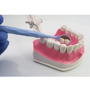 Espejo bucal dental colorido tratamiento de odontología espejo reflectante intraoral - Product Image 6