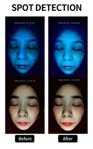 सौंदर्य सैलून के लिए Au-997 थोक ओएम/ओडी एआई बुद्धिमान त्वचा खोपड़ी विश्लेषण के साथ - Product Image 6