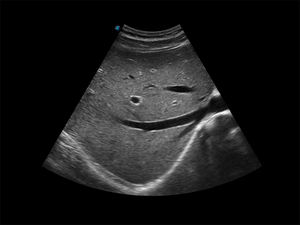 X3 Sonosape Mesin Elektrokardiografi Portabel Harga Doppler Cembung Linier Transduser Jantung - Product Image 6