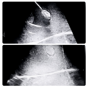 Scalptek Phantom d'entraînement à l'ablation par pénétration visualisée avec indicateur thermique à changement de couleur pour l'ablation par radiofréquence et micro-ondes - Product Image 4