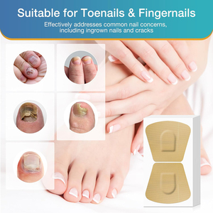 Parche <span class=keywords><strong>de</strong></span> Gel Protector para <span class=keywords><strong>Uñas</strong></span>, Adhesivo Antihongos para el Cuidado <span class=keywords><strong>de</strong></span> <span class=keywords><strong>las</strong></span> <span class=keywords><strong>Uñas</strong></span>, Parche <span class=keywords><strong>de</strong></span> Renovación <span class=keywords><strong>de</strong></span> <span class=keywords><strong>Uñas</strong></span>, Venta al por Mayor <span class=keywords><strong>de</strong></span> Fábrica, Personalización Disponible - Product Image 2