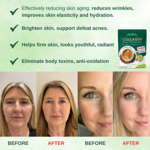 Toptan Fabrika Oem Paketleme L-Glutatyon Kolajen Chia Kahvesi Fitgum 20x Kolajen Chia Kahvesi Zayıflama Kahvesi Kolajenli - Product Image 5