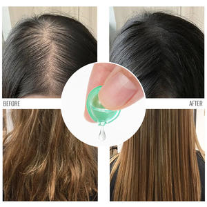 Label pribadi Vitamin E minyak pertumbuhan pelembab perawatan rambut minyak Argan perawatan kapsul minyak <span class=keywords><strong>Rosemary</strong></span> kapsul Vitamin rambut - Product Image 4