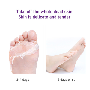 <span class=keywords><strong>Masque</strong></span> exfoliant pour les pieds à la lavande, marque privée OEM ODM, éliminateur de callosités, élimination des peaux mortes, chaussettes hydratantes pour le soin des pieds - Product Image 5