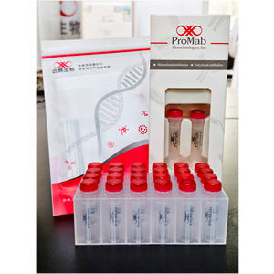 칼레티쿨린-프로마비오 마우스 단일클론항체, -20도에서 12개월 동안 유효, WB/IHC/IF/FCM 적용 가능 - Product Image 3