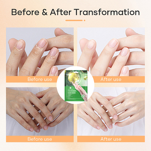Oem masker tangan hidrasi Anti Penuaan, perawatan Spa intensif tangan kering meningkatkan tekstur kulit kecantikan Niacinamide sarung tangan - Product Image 4