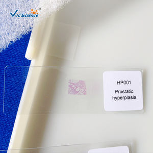 Il Laboratorio dell'Università Medica ha Preparato Vetrini Microscopici del Sistema Respiratorio Umano - Product Image 4