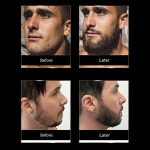 Olio di Argan <span class=keywords><strong>e</strong></span> Jojoba naturale puro olio per la crescita della <span class=keywords><strong>barba</strong></span> per la ricrescita dei <span class=keywords><strong>baffi</strong></span> per il trattamento di manutenzione della <span class=keywords><strong>barba</strong></span> <span class=keywords><strong>e</strong></span> dei <span class=keywords><strong>baffi</strong></span> - Product Image 4