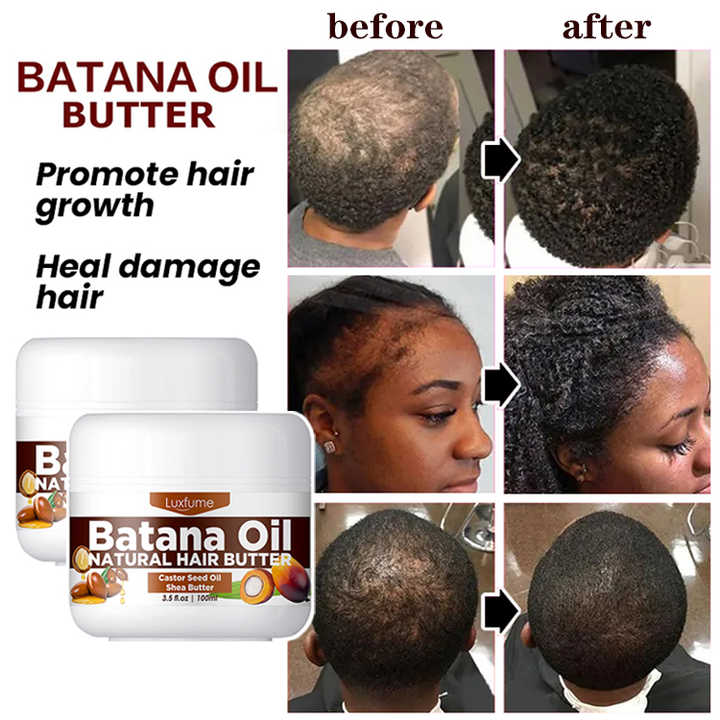Luxfume Wholesale Batana Oil Hair Growth Butter Cream Nourishing