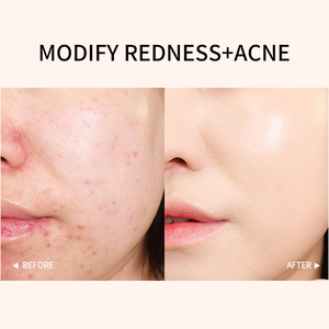 Crème de contour GECOMO pour couvrir les cicatrices d'acné, les taches, les sillons nasogéniens, embellir, éclaircir, correcteur naturel trois couleurs - Product Image 5